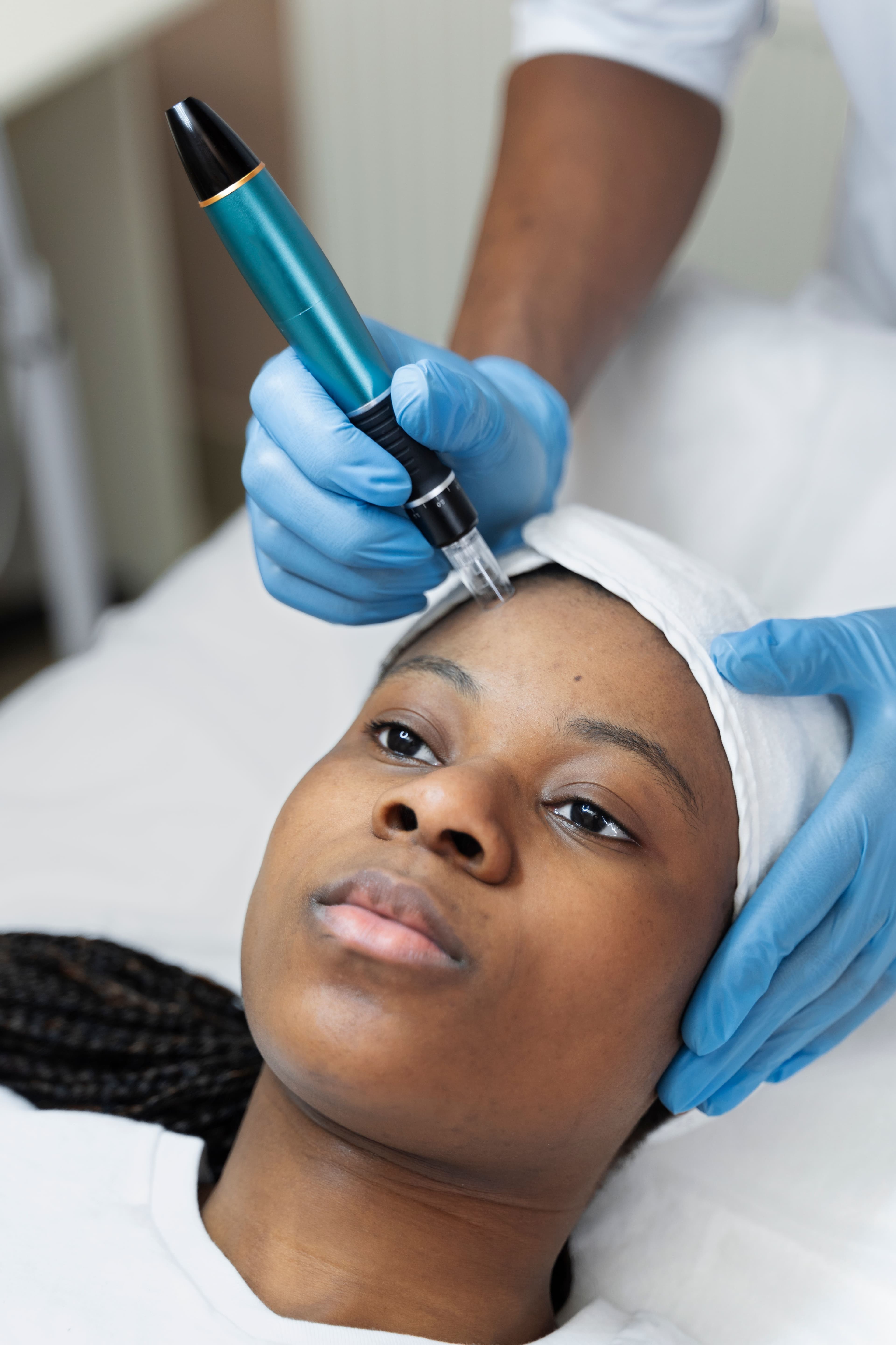 What is LuxeGlow Microneedling? bigger image