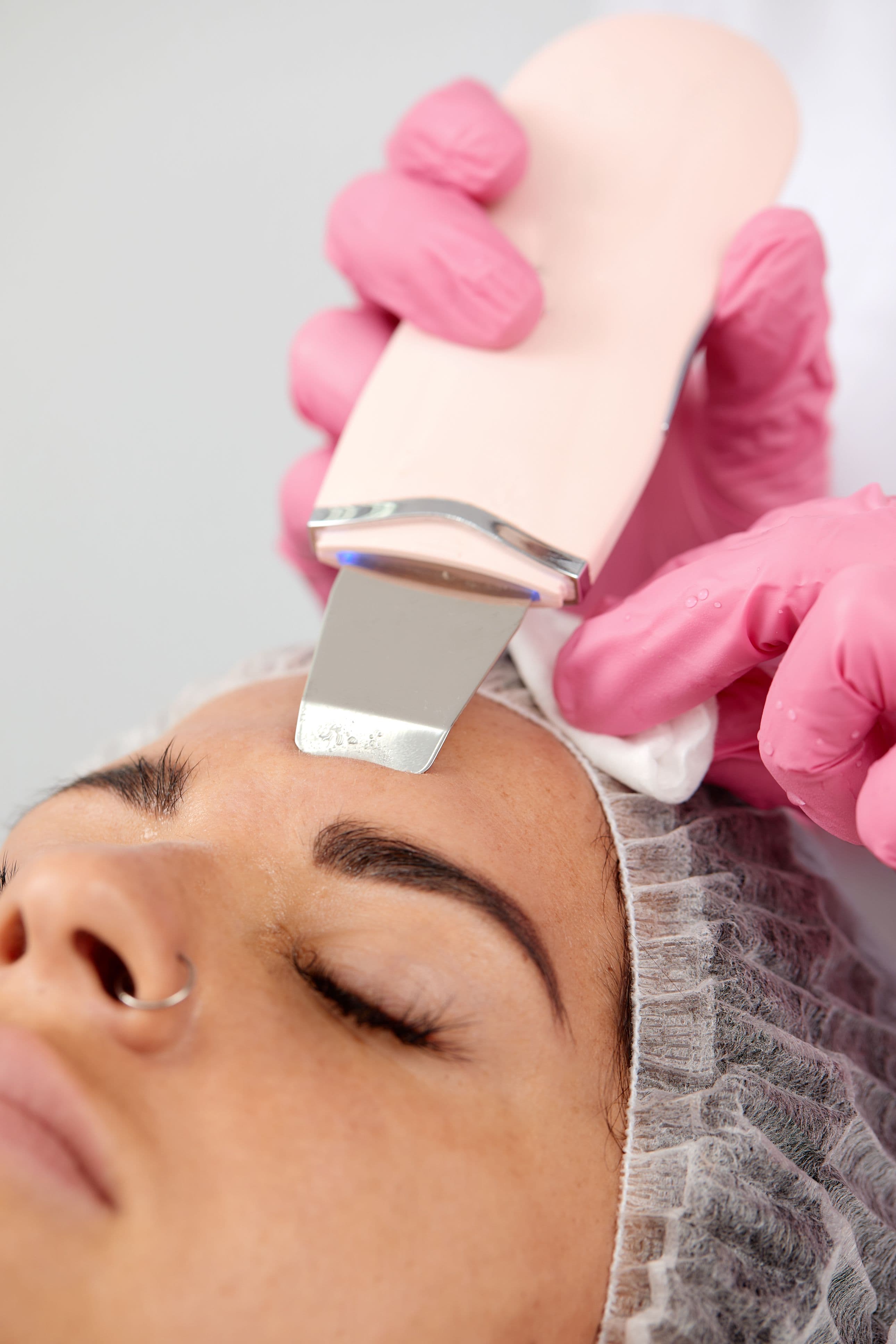 Why Consider Laser Hair Removal for Brows? bigger image