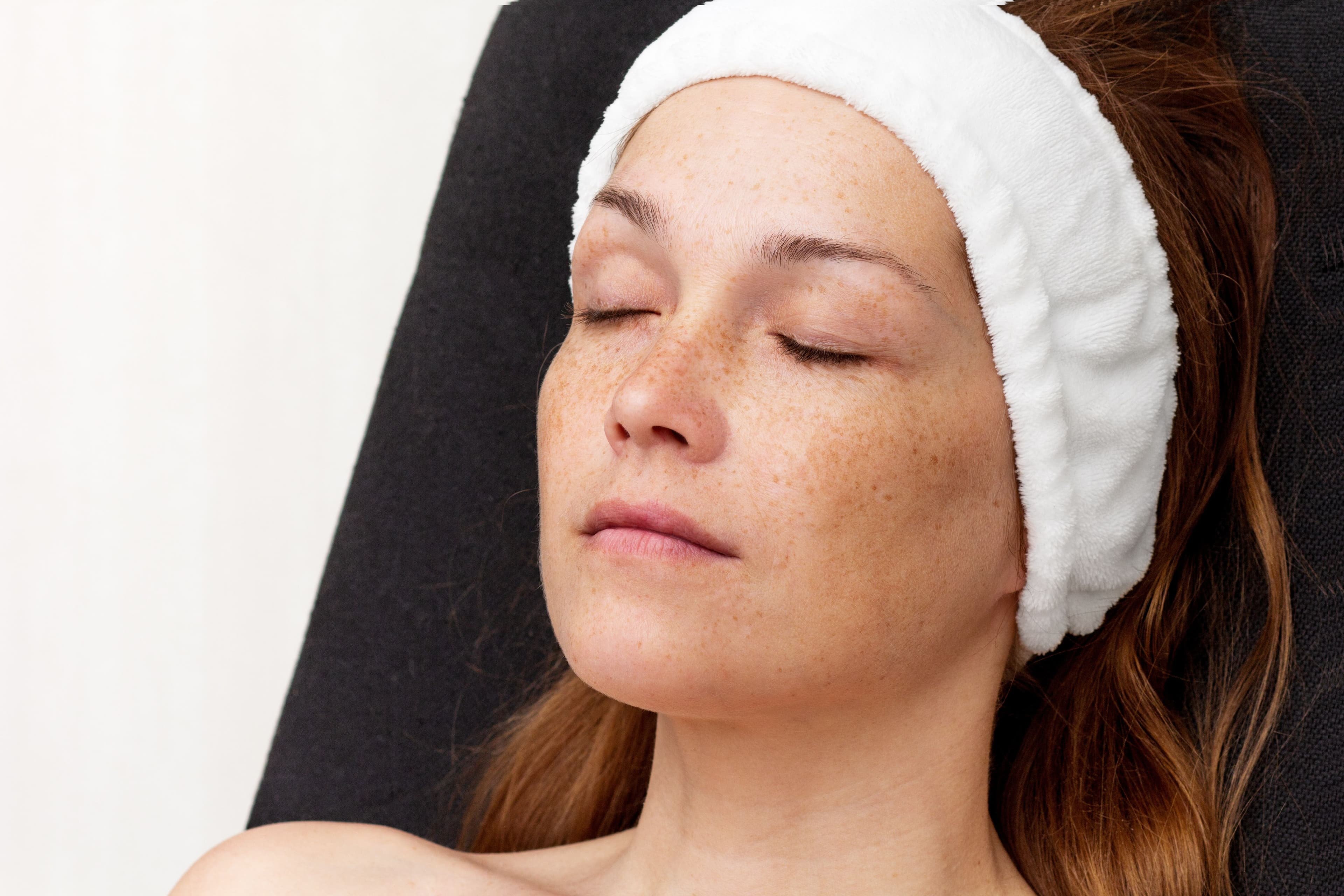 Brown Spots Everything You Need to Know