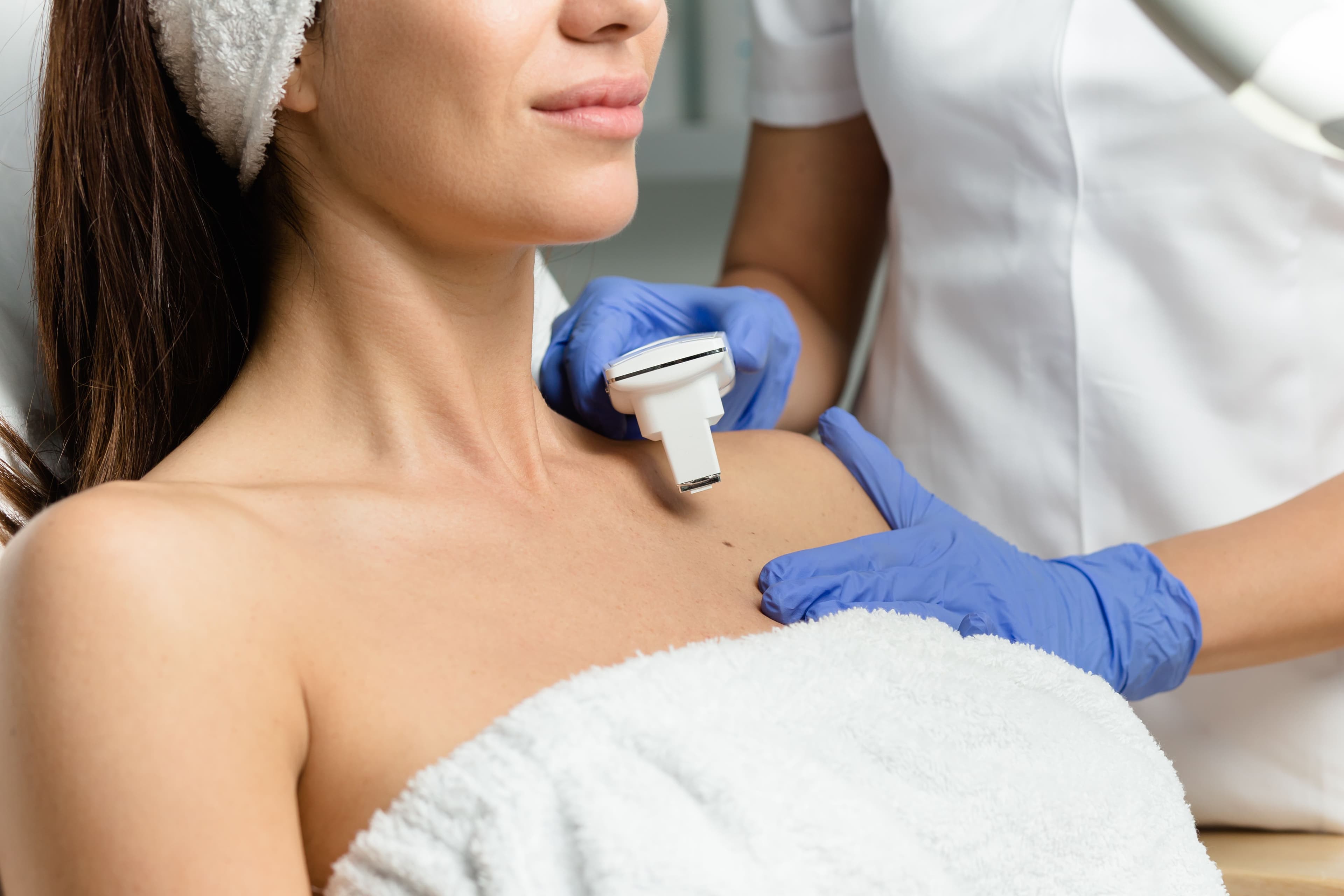 Smooth, Hair-Free Shoulders with Laser Treatment smaller image