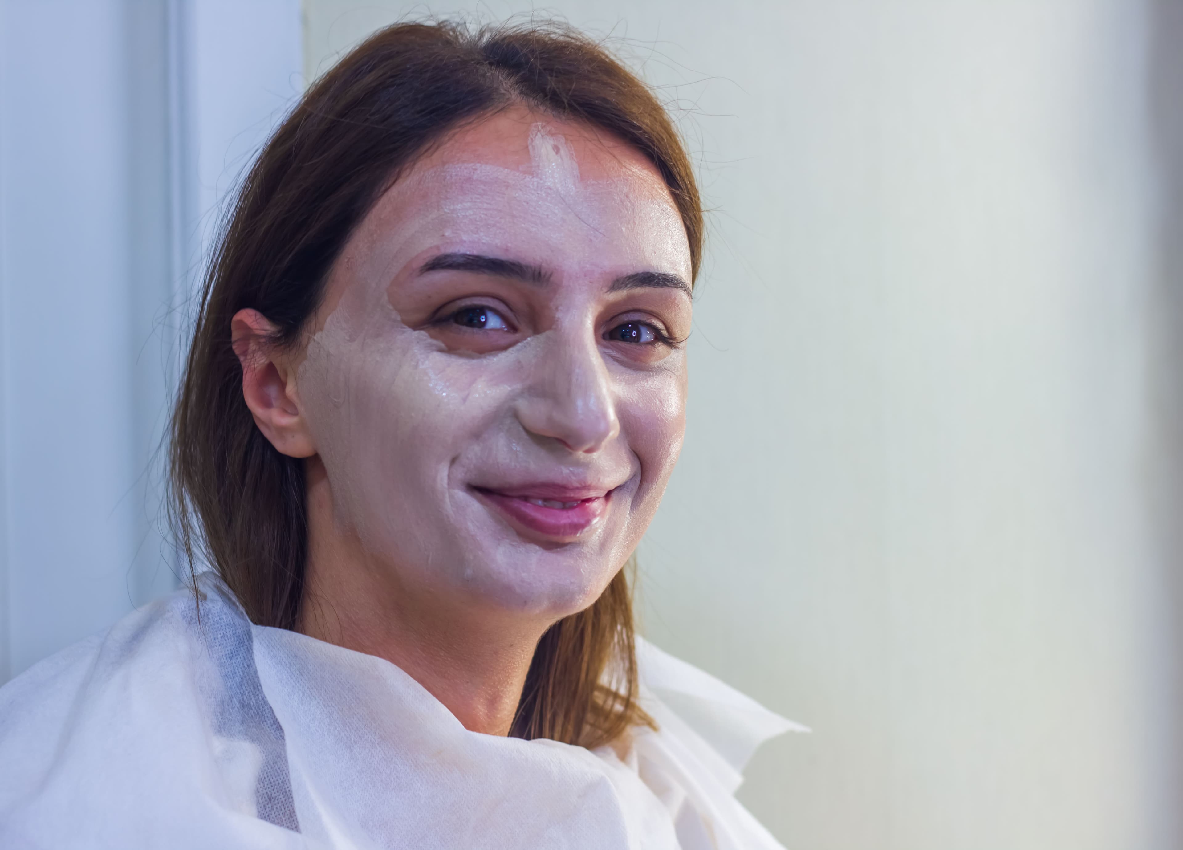 Experience Ultimate Skin Renewal with VI Peel