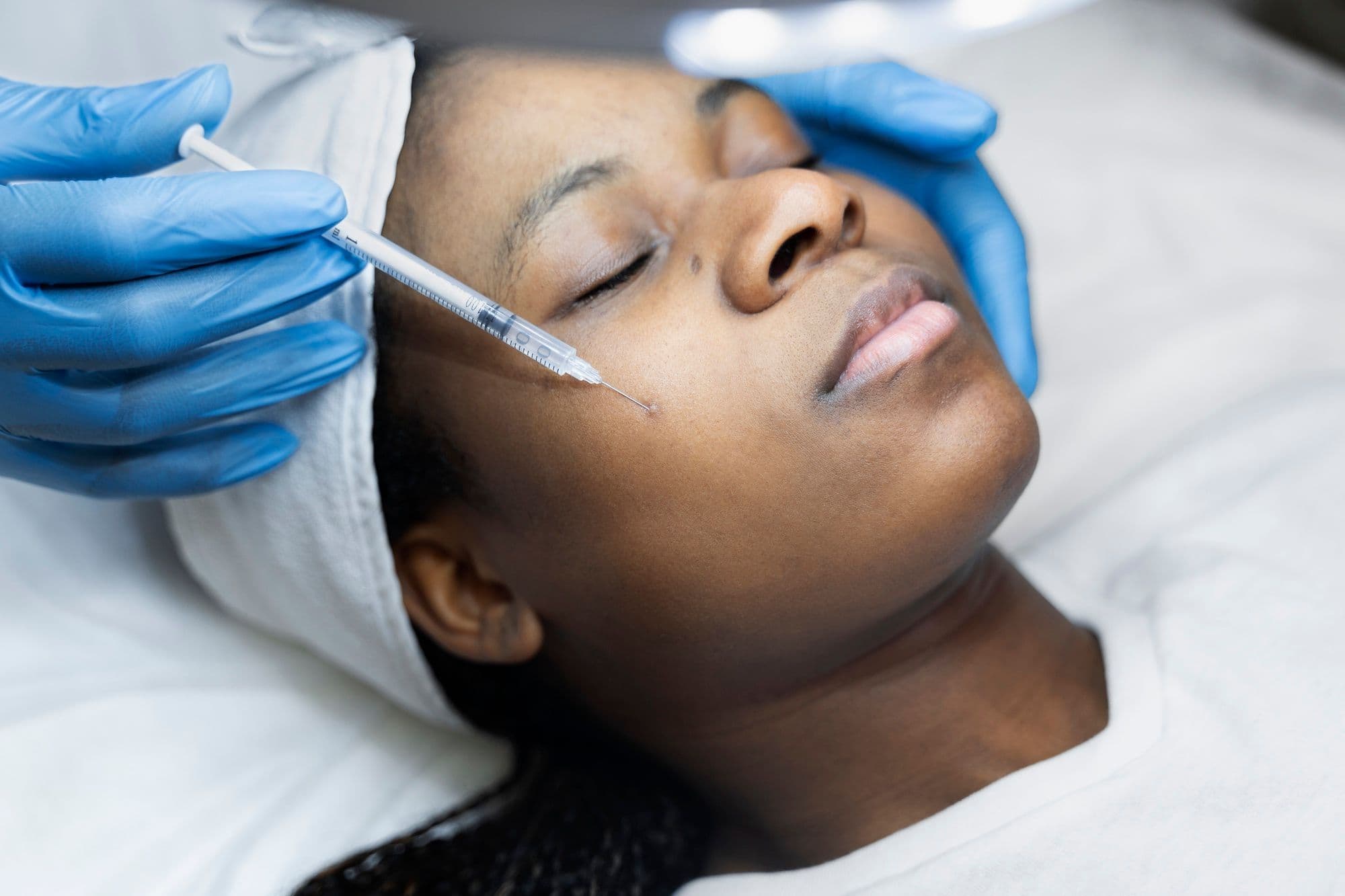 Microneedling with PRP: A Healing Elixir for Your Skin smaller image